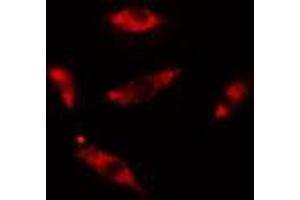 ABIN6275437 staining HuvEc cells by IF/ICC. (Rabenosyn 5 antibody  (Internal Region))