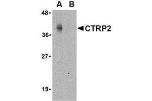 Western blot analysis of CTRP2 in Caco-2 cell lysate with AP30249PU-N CTRP2 antibody at 1 μg/ml in either the (A) absence or (B) presence of blocking peptide. (C1QTNF2 antibody  (N-Term))