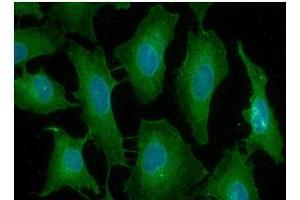 ICC/IF analysis of PDCP1 in HeLa cells line, stained with DAPI (Blue) for nucleus staining and monoclonal anti-human PDCD1 antibody (1:100) with goat anti-mouse IgG-Alexa fluor 488 conjugate (Green). (PD-1 antibody  (AA 21-167))