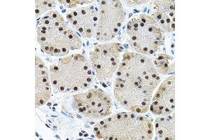 Immunohistochemistry of paraffin-embedded human stomach using EIF4G2 antibody (ABIN5971499) (40x lens). (EIF4G2 antibody)