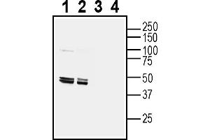 Western blot analysis of mouse brain lysate (lanes 1 and 3) and rat brain lysate (lanes 2 and 4):1-2.
