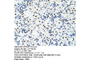 Human Liver (TARDBP antibody  (C-Term))