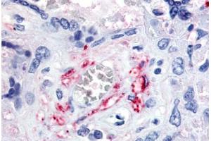 Human Placenta, Fetal Capillary Endothelial Cells (formalin-fixed, paraffin-embedded) stained with FLT1 antibody ABIN213617 at 5-10 ug/ml followed by biotinylated goat anti-rabbit IgG secondary antibody ABIN481713, alkaline phosphatase-streptavidin and chro . (FLT1 antibody  (N-Term))