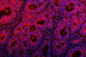 IF analysis of TOM1L1 using anti-TOM1L1 antibody (ABIN7602631).