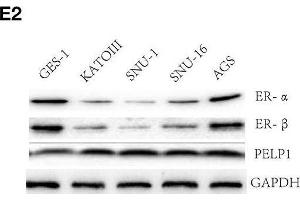 PELP1 expression was elevated in gastric cancer tissues and cells comparing with corresponding counterparts. (PELP1 antibody)
