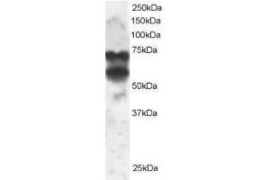 Image no. 1 for anti-Protein Phosphatase 2, Regulatory Subunit B', delta (PPP2R5D) (C-Term) antibody (ABIN374132) (PPP2R5D antibody  (C-Term))