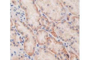 Used in DAB staining on fromalin fixed paraffin- embedded Kidney tissue (SRP9 antibody  (AA 2-86))