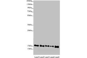 Western blot All lanes: ATP5F1D antibody at 2. (ATP5F1D antibody  (AA 1-168))