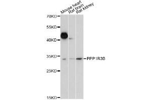 Western blot analysis of extracts of various cell lines, using PPP1R3B antibody (ABIN6293886) at 1:1000 dilution. (PPP1R3B antibody)