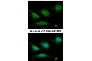 ICC/IF Image Immunofluorescence analysis of methanol-fixed HeLa, using DNA polymerase gamma, antibody at 1:200 dilution. (POLG antibody  (C-Term))