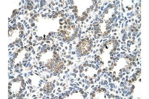 TST antibody was used for immunohistochemistry at a concentration of 4-8 ug/ml to stain Alveolar cells (arrows) in Human Lung.