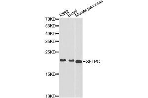 Western blot analysis of extracts of various cell lines, using SFTPC antibody (ABIN5970936) at 1/1000 dilution. (Surfactant Protein C antibody)