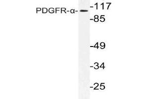 Western blot (WB) analysis of PDGFR-alpha antibody in extracts from Jurkat cells. (PDGFRA antibody)