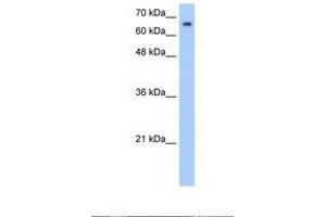 Image no. 1 for anti-Synovial Apoptosis Inhibitor 1, Synoviolin (SYVN1) (AA 371-420) antibody (ABIN320785) (SYVN1 antibody  (AA 371-420))