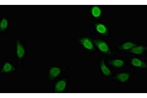 Immunofluorescent analysis of A549 cells using ABIN7150418 at dilution of 1:100 and Alexa Fluor 488-congugated AffiniPure Goat Anti-Rabbit IgG(H+L) (POLR2M antibody  (AA 2-91))