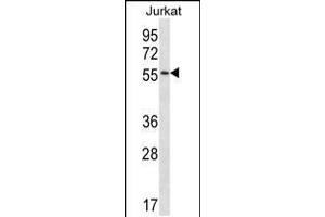 Western blot analysis in Jurkat cell line lysates (35ug/lane). (C1RL antibody  (AA 161-190))