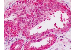 Immunohistochemistry (IHC) image for anti-Signal Transducer and Activator of Transcription 2, 113kDa (STAT2) (C-Term) antibody (ABIN1804117)