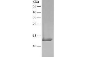 ARPC5 Protein (AA 1-151) (His tag)