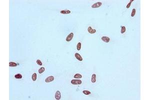 Immunocytochemistry (ICC) image for anti-Histone Cluster 1, H4a (HIST1H4A) (acLys16) antibody (ABIN7127270)