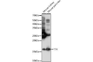 Western blot analysis of extracts of various cell lines, using TTR Rabbit mAb (ABIN1682449, ABIN3018489, ABIN3018490 and ABIN7101619) at 1:1000 dilution. (TTR antibody)