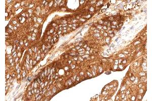 ABIN6268729 at 1/100 staining human Stomach tissue sections by IHC-P. (Cathepsin E antibody  (Internal Region))