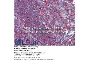 Immunohistochemistry (IHC) image for anti-Phosphatase and Actin Regulator 1 (PHACTR1) (Middle Region) antibody (ABIN2786181) (PHACTR1 antibody  (Middle Region))