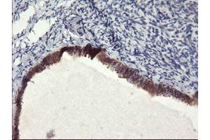 Immunohistochemical staining of paraffin-embedded Human Ovary tissue using anti-FBXO21 mouse monoclonal antibody. (FBXO21 antibody)
