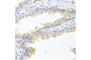 Immunohistochemistry of paraffin-embedded human prostate using ApoE antibody (ABIN5975768) at dilution of 1/100 (40x lens). (APOE antibody)