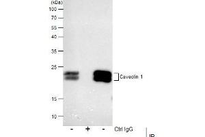 IP Image Immunoprecipitation of Caveolin 1 protein from A549 membrane extracts using 5 μg of Caveolin 1 antibody [N1N3], Western blot analysis was performed using Caveolin 1 antibody [N1N3], EasyBlot anti-Rabbit IgG  was used as a secondary reagent.