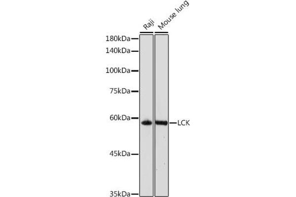 LCK antibody  (AA 1-240)
