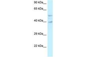 Image no. 1 for anti-Glutamate Receptor, Ionotropic, N-Methyl D-Aspartate-Like 1A (GRINL1A) (C-Term) antibody (ABIN6747700)