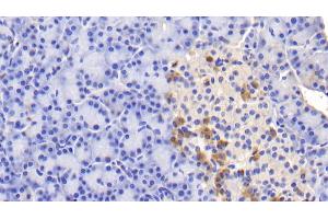 Detection of INSR in Human Pancreas Tissue using Polyclonal Antibody to Insulin Receptor (INSR) (Insulin Receptor antibody  (AA 1024-1298))