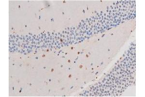 Immunohistochemistry (IHC) image for anti-Insulin Receptor Substrate 1 (IRS1) (pSer636) antibody (ABIN6255436)