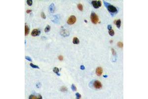 Immunohistochemical analysis of CHRAC1 staining in human brain formalin fixed paraffin embedded tissue section. (CHRAC1 antibody  (C-Term))