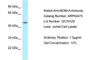 Western Blotting (WB) image for anti-MON1 Homolog A (MON1A) (N-Term) antibody (ABIN2788457) (MON1A antibody  (N-Term))
