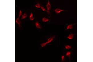 ABIN6274920 staining COLO205 by IF/ICC. (BMP8A antibody  (Internal Region))