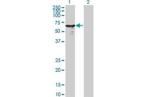 Western Blot analysis of L3MBTL4 expression in transfected 293T cell line by L3MBTL4 monoclonal antibody (M01), clone 1B9-1C12. (L3MBTL4 antibody  (AA 1-534))