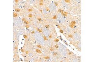 Immunohistochemistry of paraffin embedded rat brain using erf1 (ABIN7073895) at dilution of 1: 2400 (400x lens) (ETF1 antibody)