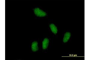 Immunofluorescence of purified MaxPab antibody to KCTD15 on HeLa cell.