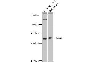 Western Blotting (WB) image for anti-SNAIL (SNAI1) (C-Term) antibody (ABIN6148177)