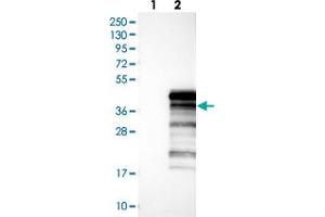 Western blot analysis of Lane 1: Negative control (vector only transfected HEK293T lysate), Lane 2: Over-expression Lysate (Co-expressed with a C-terminal myc-DDK tag (~3. (UBXN10 antibody)