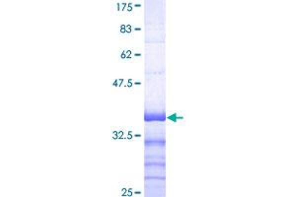 ATP7A Protein (AA 1406-1500) (GST tag)