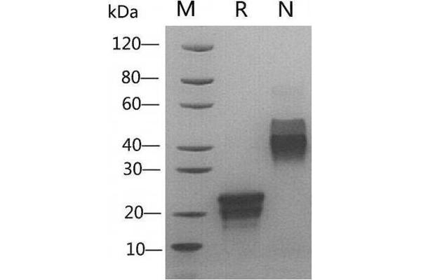 VEGF Protein