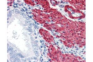 Anti-TAGLN / SM22 antibody IHC of human uterus. (Transgelin antibody  (AA 190-201))