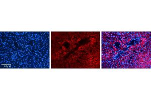 Rabbit Anti-CPT2 Antibody   Formalin Fixed Paraffin Embedded Tissue: Human Liver Tissue Observed Staining: Cytoplasm in hepatocytes Primary Antibody Concentration: N/A Other Working Concentrations: 1:600 Secondary Antibody: Donkey anti-Rabbit-Cy3 Secondary Antibody Concentration: 1:200 Magnification: 20X Exposure Time: 0. (CPT2 antibody  (N-Term))