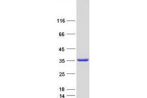 Validation with Western Blot