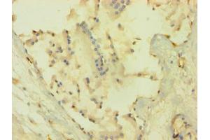Immunohistochemistry of paraffin-embedded human prostate tissue using ABIN7167024 at dilution of 1:100