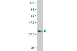 RRM2B antibody  (AA 3-84)