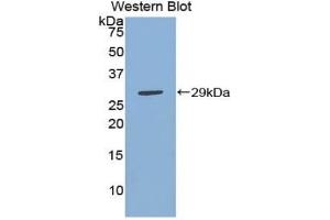 Western blot analysis of the recombinant protein. (IKbIP antibody  (AA 78-301))