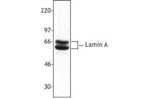 Western Blotting (WB) image for anti-Lamin A/C (LMNA) antibody (ABIN2666170) (Lamin A/C antibody)